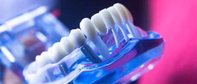 Curso implantes004.jpg AOA