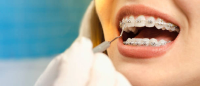 Curso ortodoncia001.jpg AOA