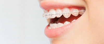 Curso ortodoncia009.jpg AOA