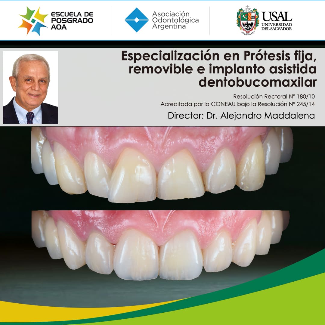 carrera especialización en Prótesis fija, removible e implanto asistida dentobucomaxilar